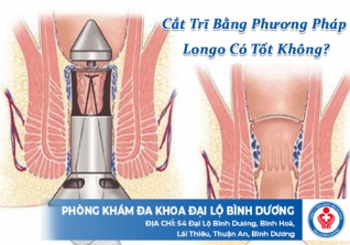 Cắt trĩ bằng phương pháp longo có tốt không?