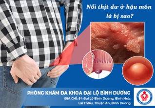 Nổi thịt dư ở hậu môn là bị sao?