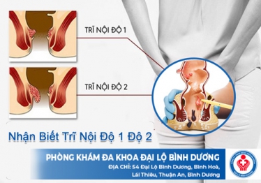 Nhận biết trĩ nội độ 1 độ 2 như thế nào?
