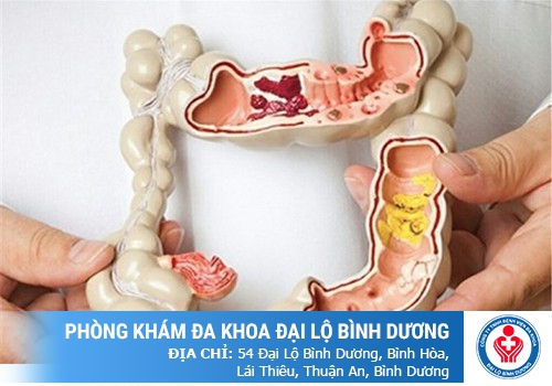 đi vệ sinh ra máu