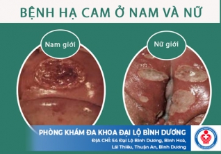 Tìm hiểu về bệnh hạ cam, có phải bệnh xã hội không?