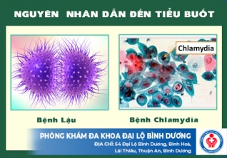 Nguyên Nhân Gây Tiểu Buốt - Dấu Hiệu Nguy Hiểm