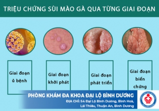Triệu chứng sùi mào gà qua từng giai đoạn