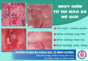 Nguy hiểm từ sùi mào gà nữ giới
