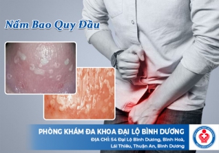 Thông tin về nấm bao quy đầu và cách điều trị hiệu quả