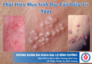 Phát hiện mụn sinh dục cần điều trị ngay