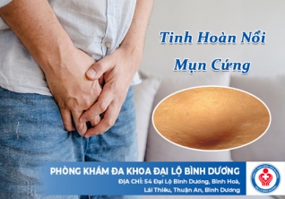 Tinh hoàn nổi mụn cứng là gì? Nguyên nhân và biến chứng thường gặp