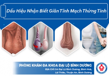 Dấu hiệu, nguyên nhân và cách điều trị giãn tĩnh mạch thừng tinh