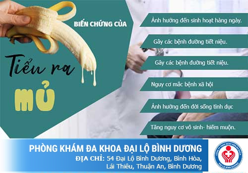 tiểu ra mủ trắng