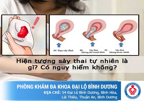 Cách làm sẩy thai tự nhiên tại Phòng Khám Đa Khoa Đại Lộ Bình Dương