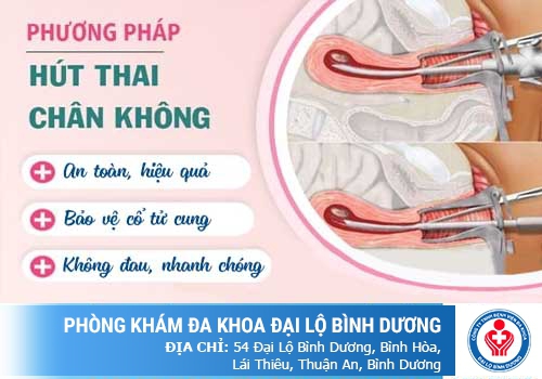  Phương pháp Mini - Giải pháp hút thai tối ưu