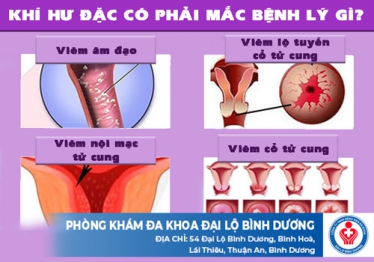 Khí hư đặc có phải mắc bệnh lý gì?