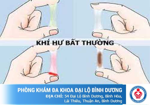 Khí hư có màu sắc bất thường