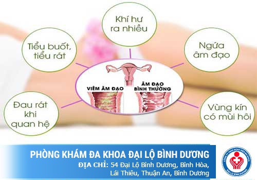 Dấu hiệu viêm vùng kín ở nữ giới