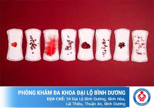 Biểu hiện bệnh kinh nguyệt