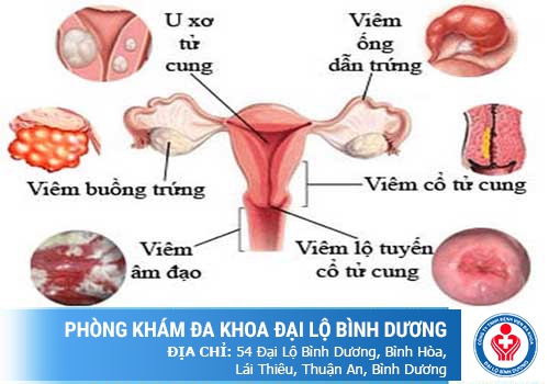 Những dấu hiệu điển hình cho thấy bạn đang mắc phải các bệnh phụ khoa nguy hiểm