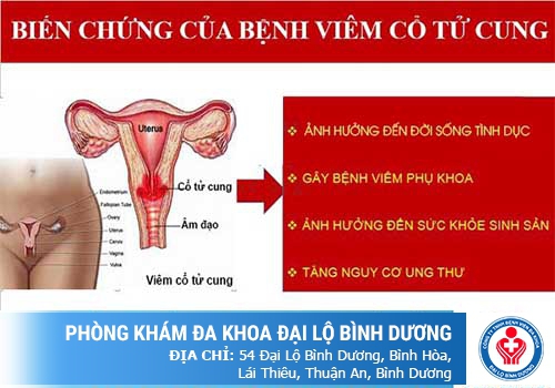 Bệnh viêm cổ tưng cung gây ra nhiều biến chứng nguy hiểm