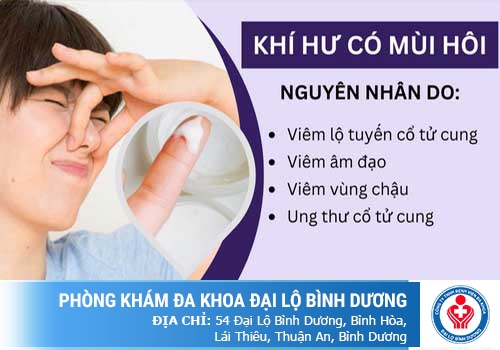 Khí hư có mùi hôi là biểu hiện của nhiều bệnh lý phụ khoa (ảnh minh họa)