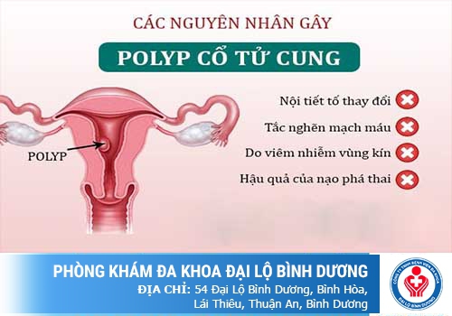 polyp